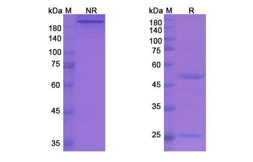 SDS-PAGE for Garadacimab Biosimilar - Anti-F12 mAb