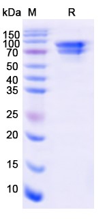 SDS-PAGE for Human Beta-catenin recombinant protein