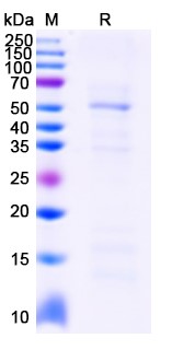 SDS-PAGE for BCL6, N-His, recombinant protein