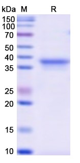 SDS-PAGE For Recombinant Monkeypox virus/MPXV B6R/SL-159 Protein
