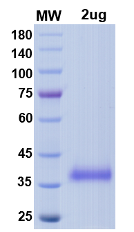 SDS-PAGE for SARS-CoV-2 RBD of Spike protein, L452R, T478K – lineage B.1.617.2 – Indian Delta Variant