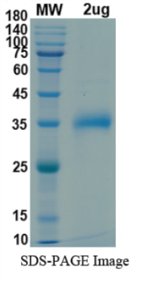 SDS-PAGE for SARS-CoV-2 RBD of Spike protein, K417N, T478K, L452R– lineage B.1.617.2.1 – Indian Delta Plus Variant