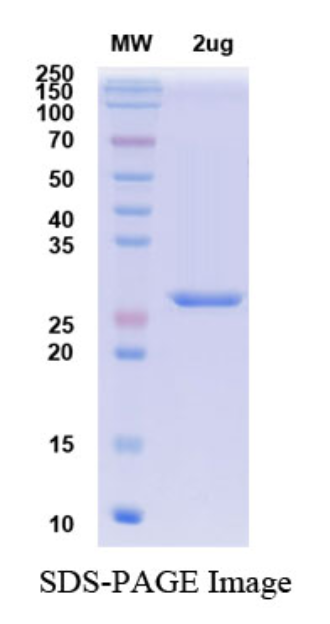 SDS-PAGE for SARS-CoV-2 RBD of Spike protein– lineage B.1.1.529 – Omicron Variant