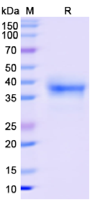 SDS-PAGE for SARS-CoV-2 RBD of Spike protein–BA.4 lineage B.1.1.529.4 – Omicron Variant