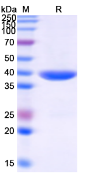 SDS-PAGE For Monkeypox virus/MPXV B16R Recombinant Protein, N-His