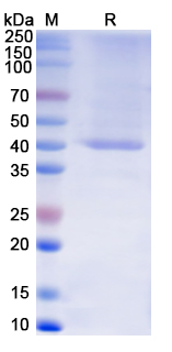 SDS-PAGE For Recombinant Monkeypox virus/MPXV B2R/Hemagglutinin Protein, N-His