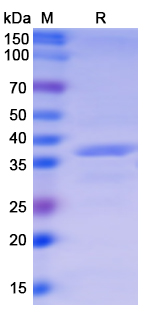 SDS-PAGE For Recombinant Monkeypox virus/MPXV A44R Protein, N-GST &amp C-His