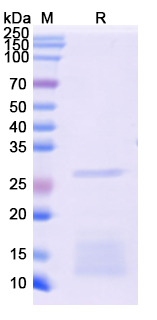 SDS-PAGE For Recombinant Monkeypox virus/MPXV H3L Protein, N-His