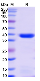 SDS-PAGE For Monkeypox virus/MPXV A35R Recombinant Protein, N-GST & C-His