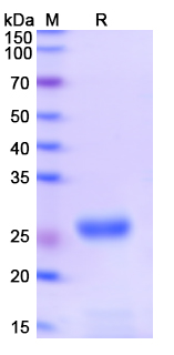 SDS-PAGE For Monkeypox virus/MPXV D14L Recombinant Protein, N-His