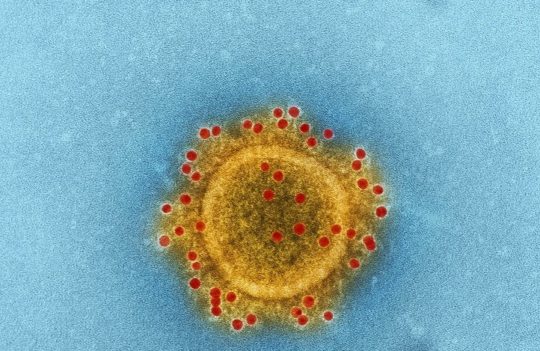 Novel Coronavirus 2019 – How to Mitigate the Impact of the New and Future Epidemics?