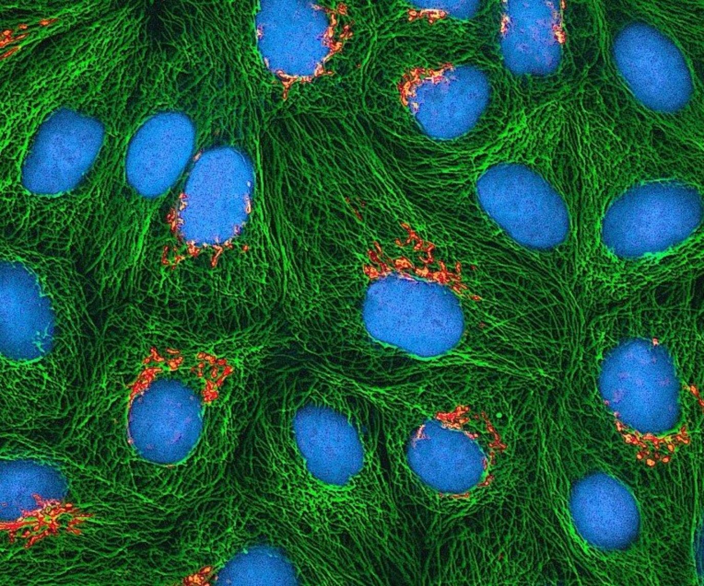 fluorescence stained cells