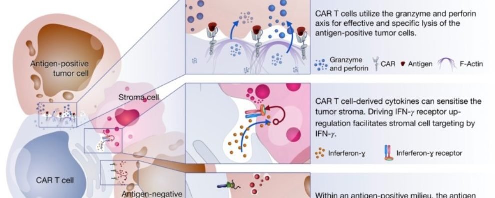 CAR-T cell immunotherapy